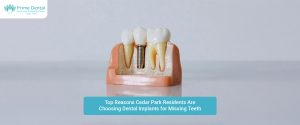 Cedar Park dental implants, dental implants near me